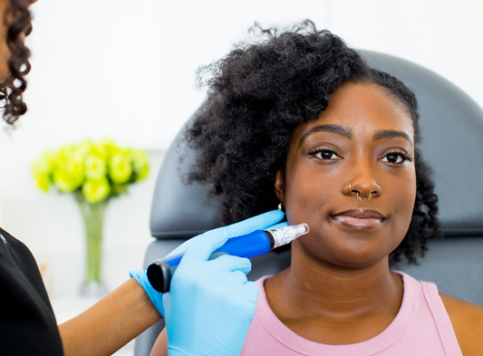 Is Skin Needling Safe for Darker Skin Tones?