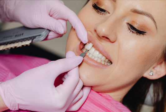 detal veneers