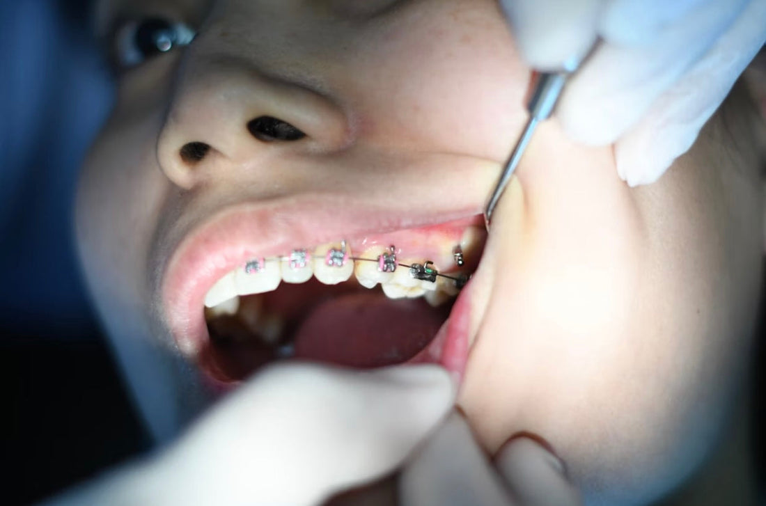 Understanding the Causes of Toothache in Children