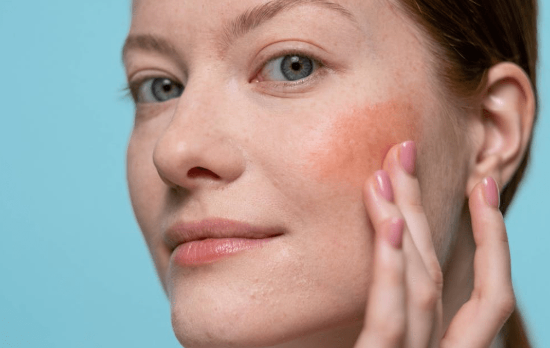 Managing Skin Concerns Amid a Busy Parenting Schedule