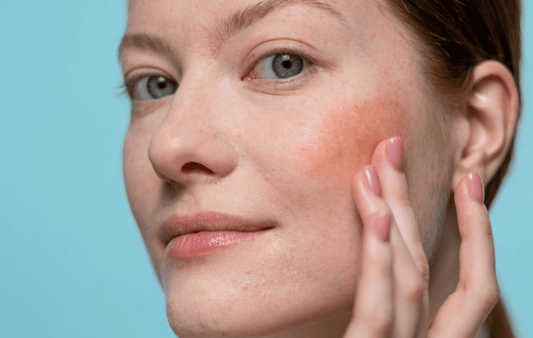 Managing Skin Concerns Amid a Busy Parenting Schedule